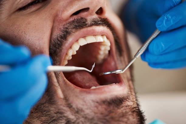 Best Mobile Emergency Dentist in Central City, IL